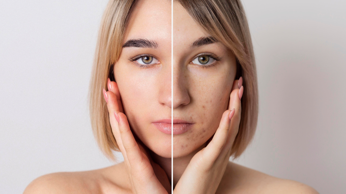 Before and after treatment results